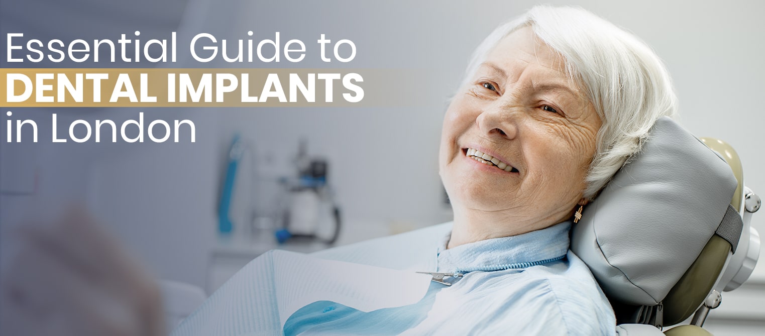 Essential Guide to Dental Implants in London